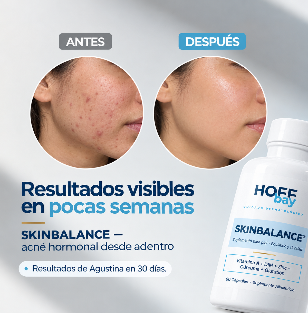 Skinbalance