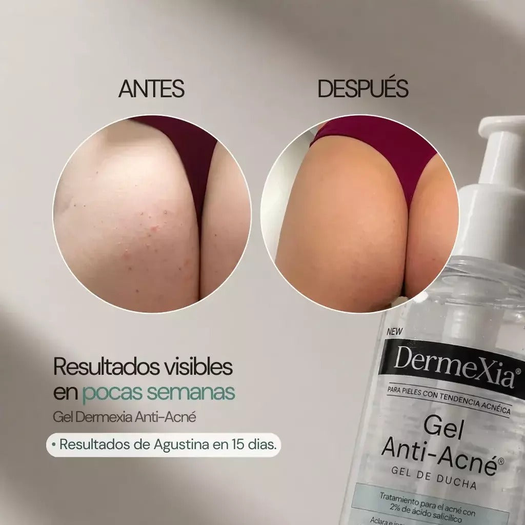 Dermexia