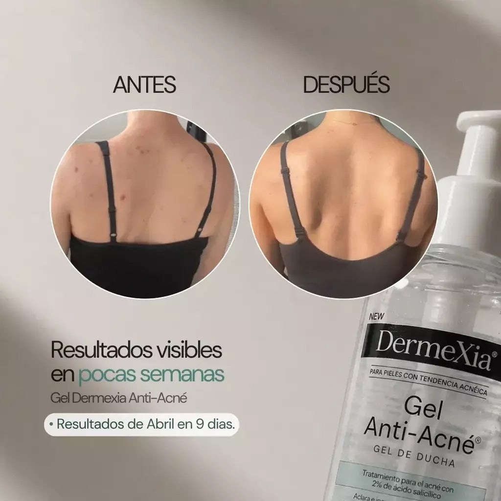 Dermexia
